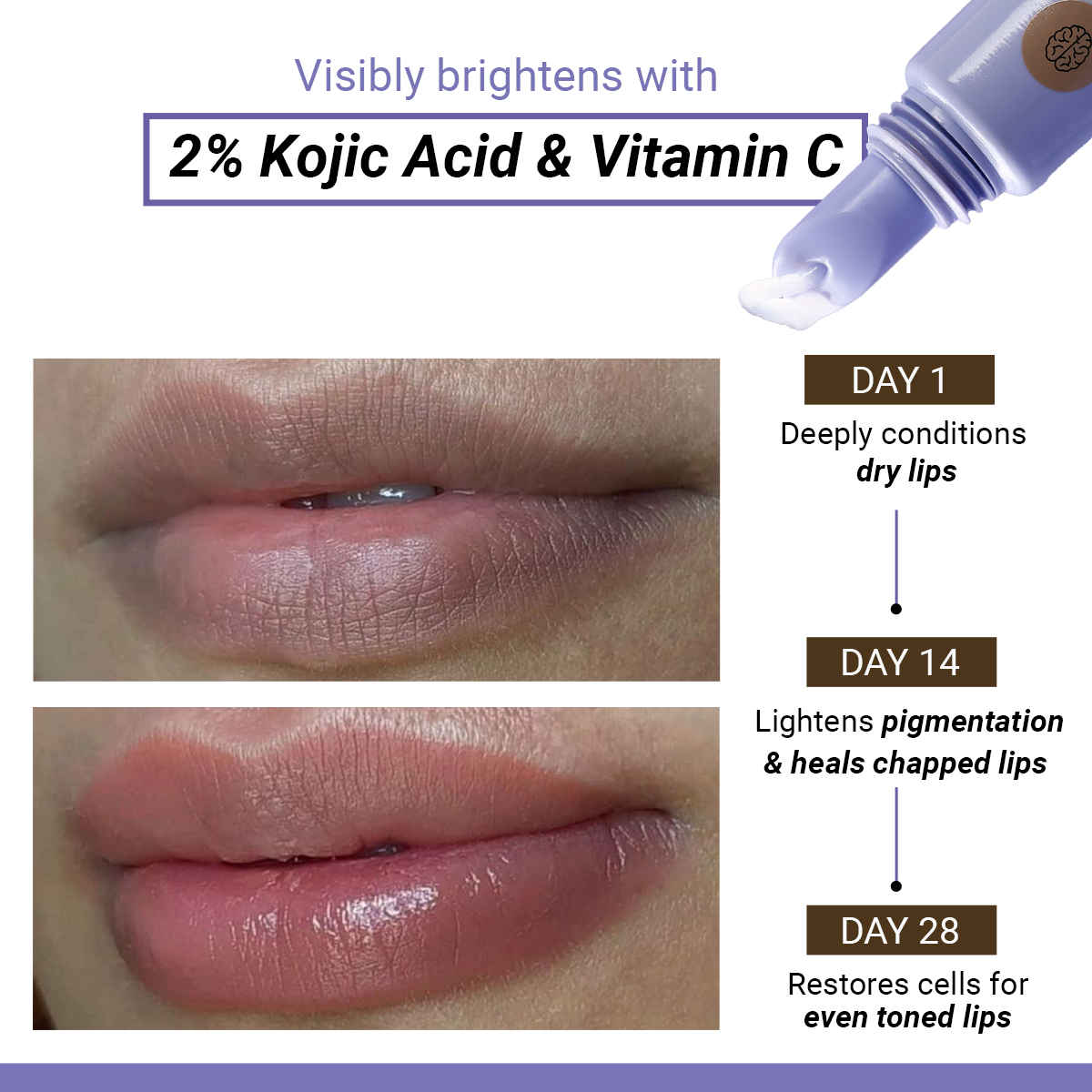 SEREKO Lip Balm with Vitamin C, Kojic Acid for Hydration, Pigmentation & Brightening - Buy at ₹427 Online | Instant Delivery