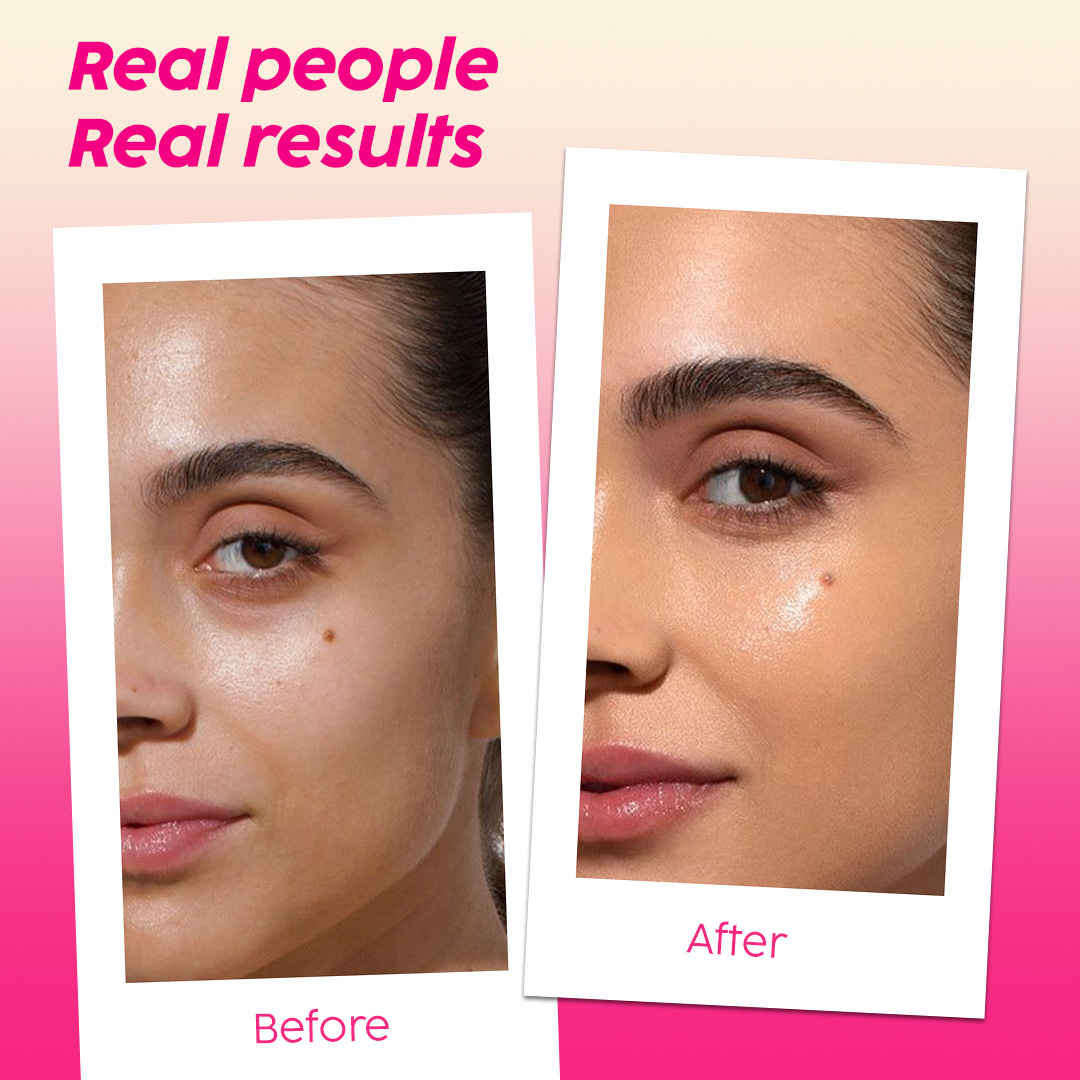plix glutathione review before and after The Plant Fix Glowy Skin Strawberry Flavour Effervescent Tablets - Buy at ₹1411 Online | Instant Delivery Purchase Type:Trio Kit Buy BPC-157 1000mcg (60 Google Shopping Best Seller