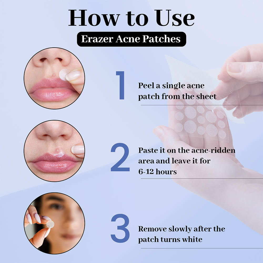 Enn Beauty Erazer Acne Patches & 2 Deep Cleansing Nose Strip Combo