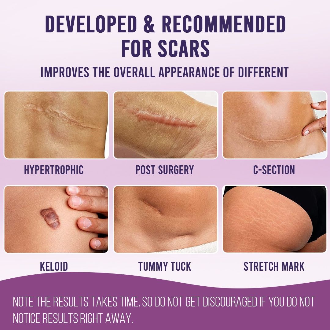 Sanfe Silicone Scar Sheet 2 sheets
