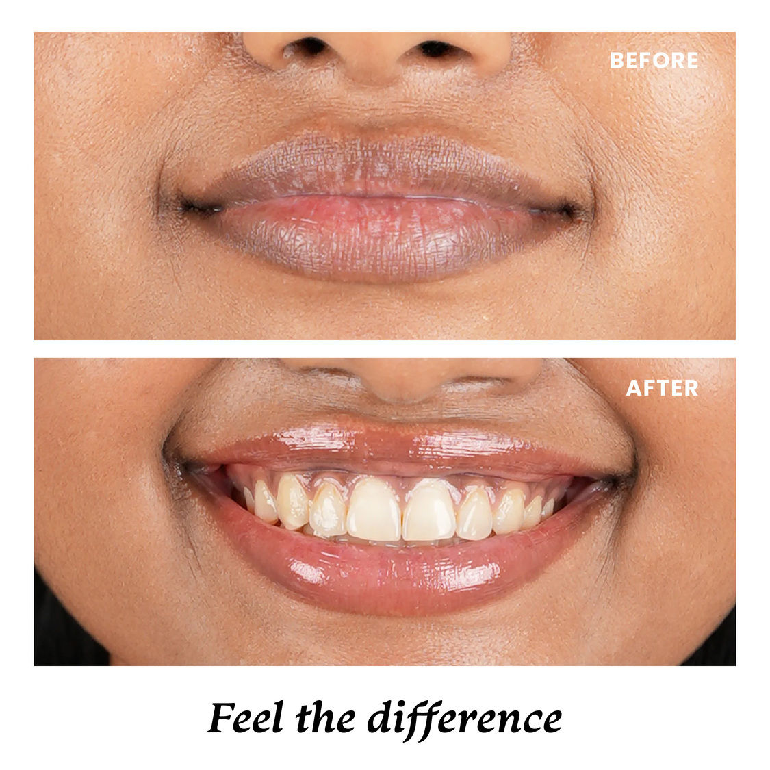Foxtale SPF 30 Brightening Lip Balm with Peptitdes