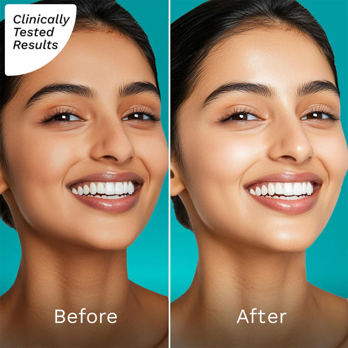 Pilgrim Squalane Glow Moisturizer For Face With Niacinamide & Vitamin C For Glowing Skin