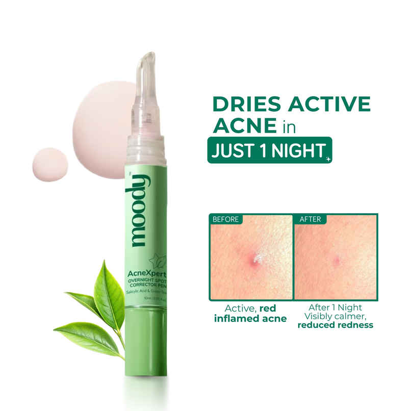 Moody Acnexpert Overnight Spot Correcting Pen With Salicylic Acid And Green Tea Moody Acnexpert Overnight Spot Correcting Pen With Salicylic Acid And Green Tea