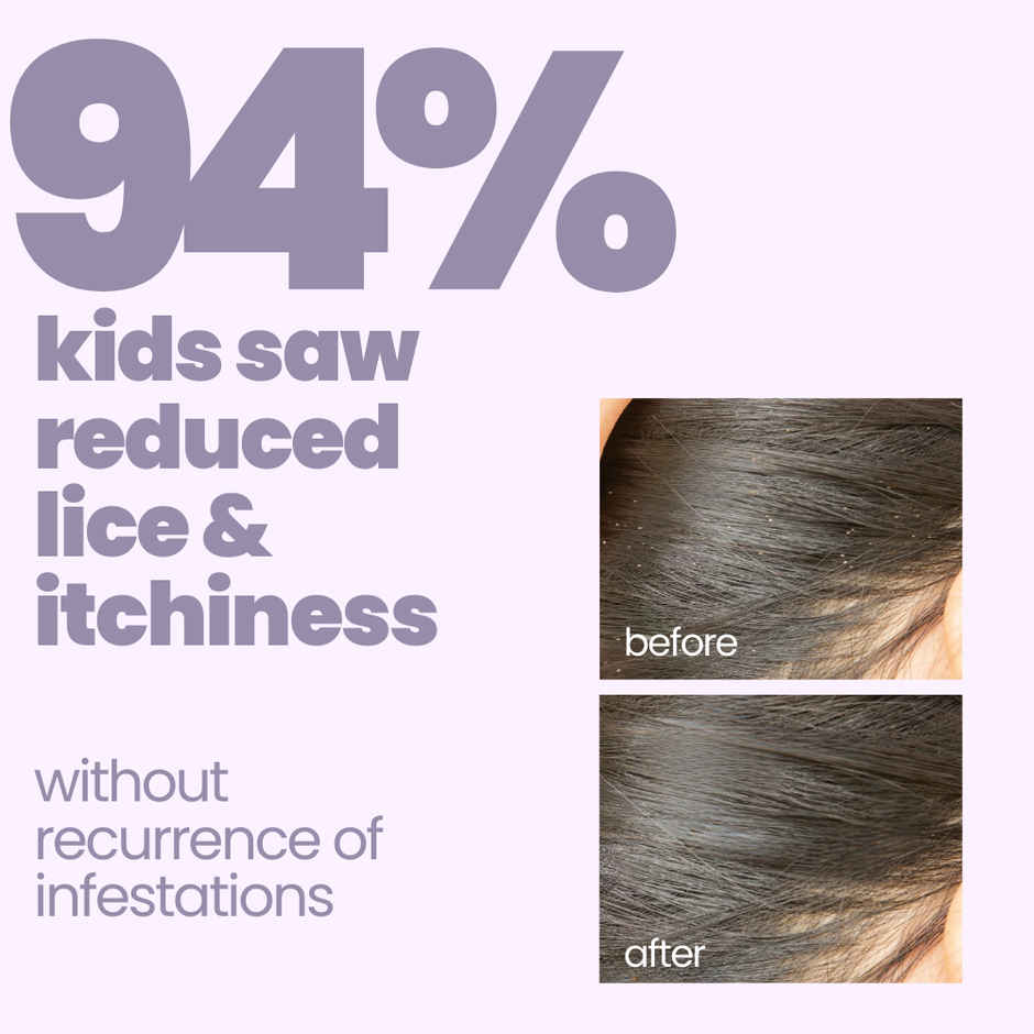 Tuco Kids Natural Anti Lice Shampoo