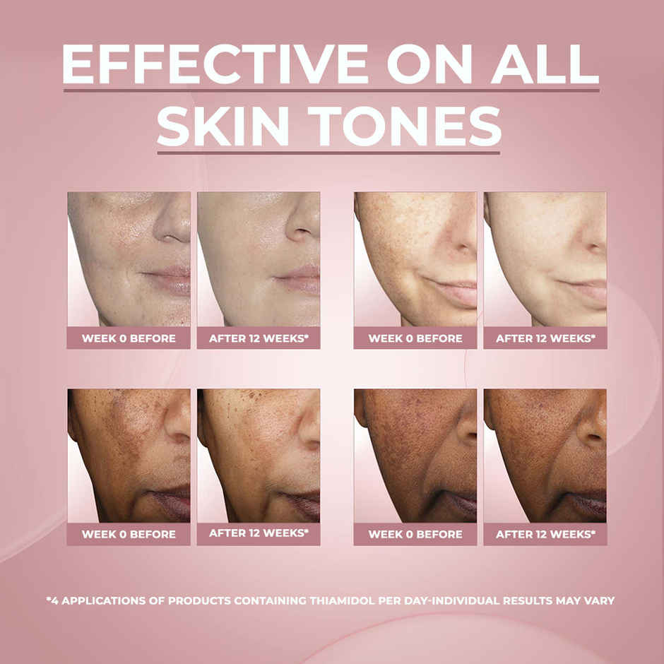 Eucerin Anti-Pigment Face Night Cream with Thiamidol, Reduces Dark Spots and Regenerates Skin