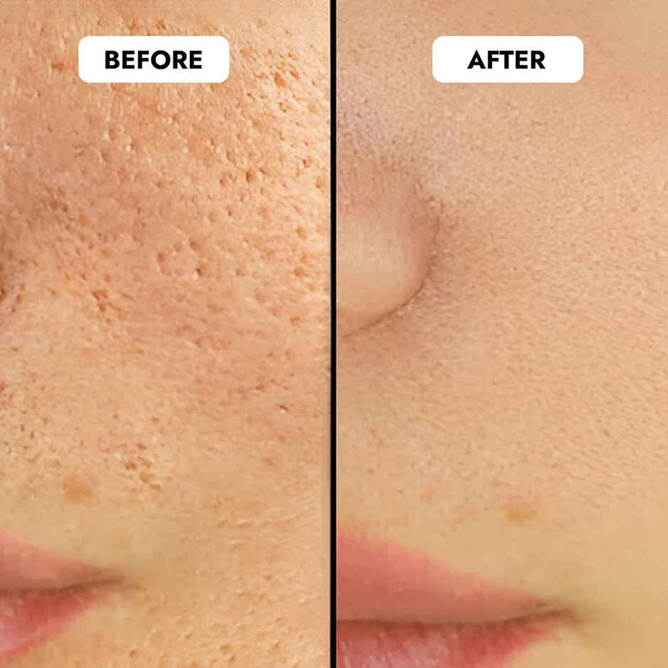 Cos-Iq Niacinamide Vitamin B3-5 Face Serum