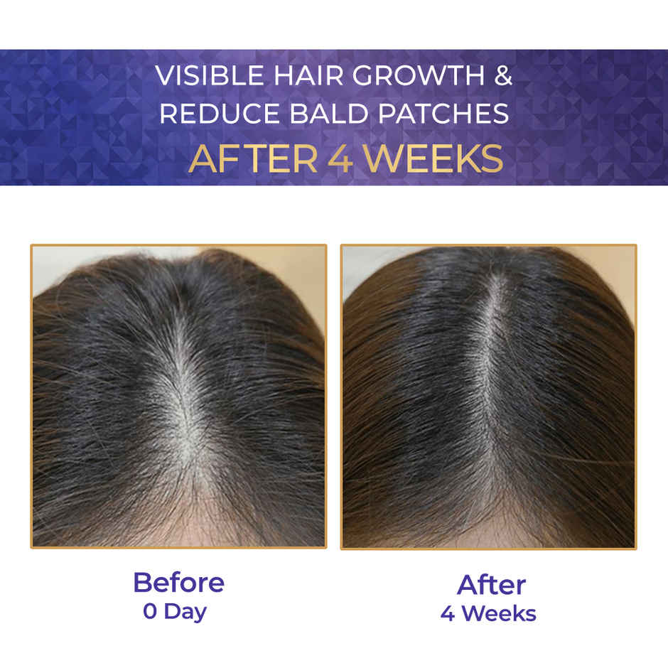 Streax Vitagrowth Hair Serum with 3% Redensyl, 4% Anagain, 3% Baicapil, Biotin & Caffeine