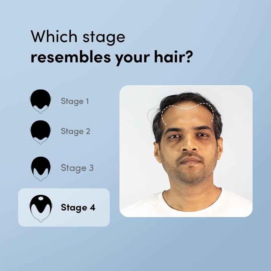 Man Matters GrowMax+ Topical Solution | for stage 4 hairfall