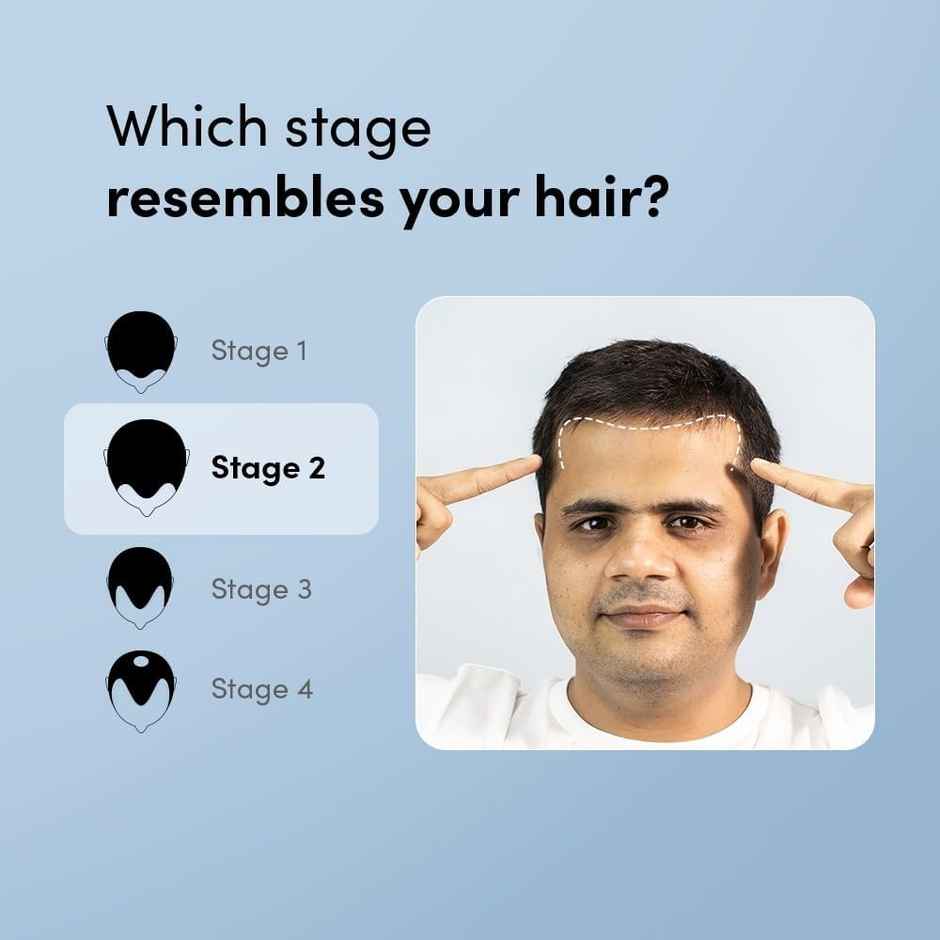 Man Matters Minoxidil 5% Growmax Topical Solution | For stage 2 hairfall