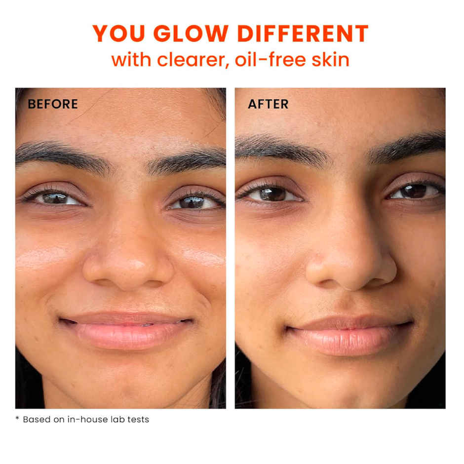 Foxtale SPF 70 Gel-Cream Sunscreen for Oily Skin with PA++++ & Niacinamide