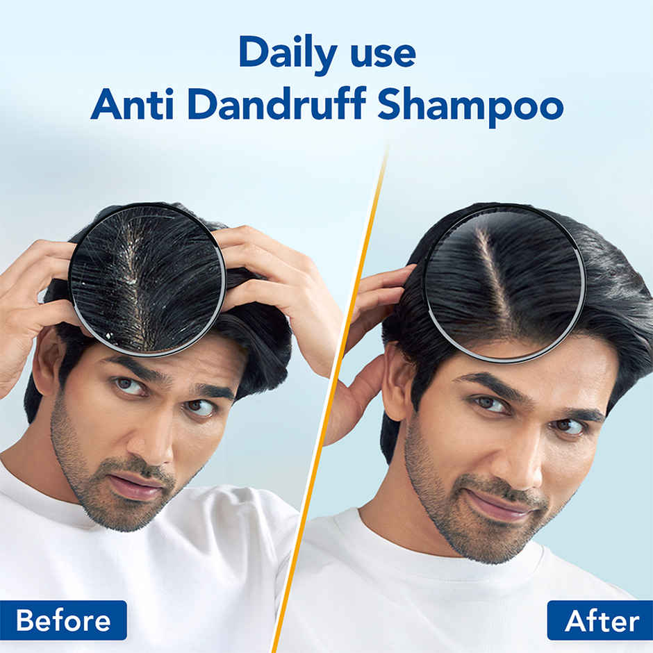 Scalpe Pro Anti dandruff Shampoo 100ml