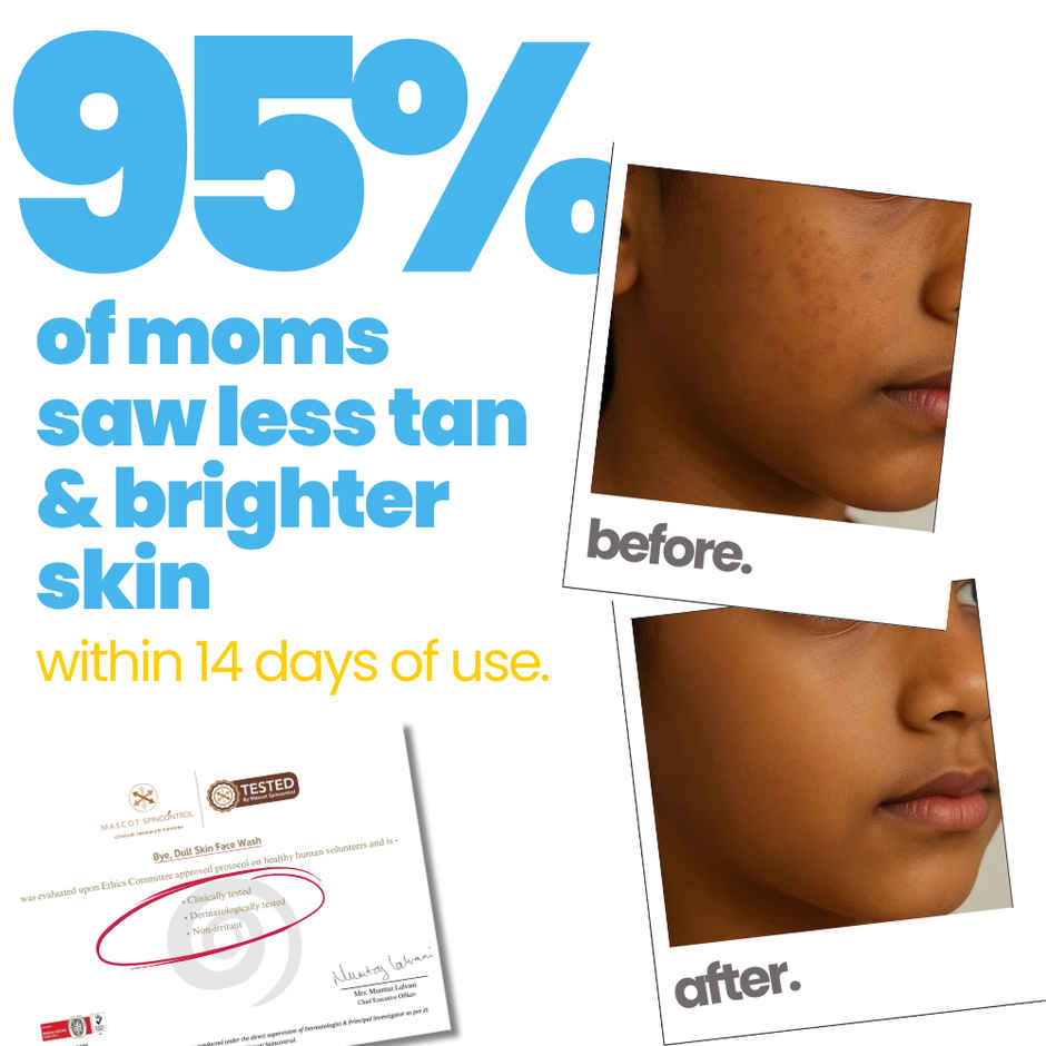 Tuco Kids Anti Dull Skin Facewash