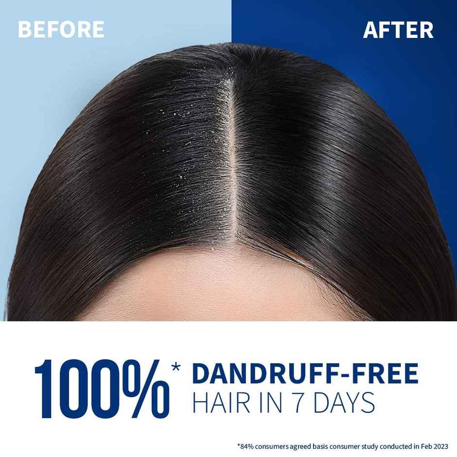 St.Botanica Anti-Dandruff Pre-Biotic Shampoo Reduces Flakes Soothes Itchy Scalp