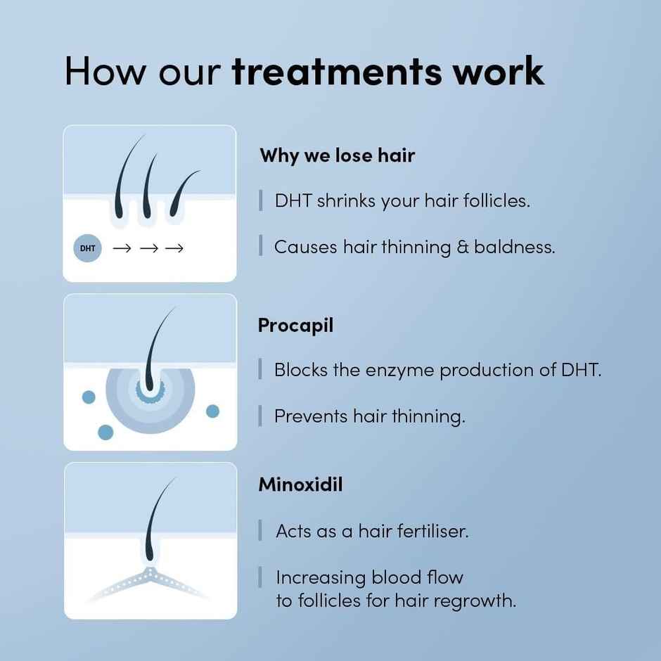 Man Matters Minoxidil 5% Growmax Topical Solution | For stage 2 hairfall