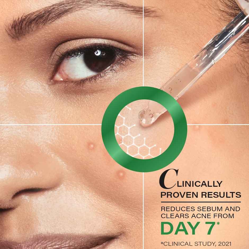 Novology Acne Serum | Face Serum For Acne | Whiteheads | Non-Sticky | Non-Comedogenic Formula