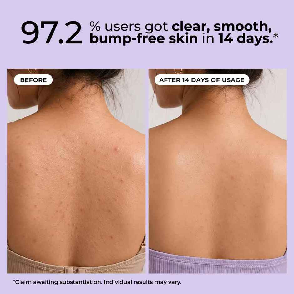 Hula Hoop 2% Salicylic Acid Exfoliating Body wash