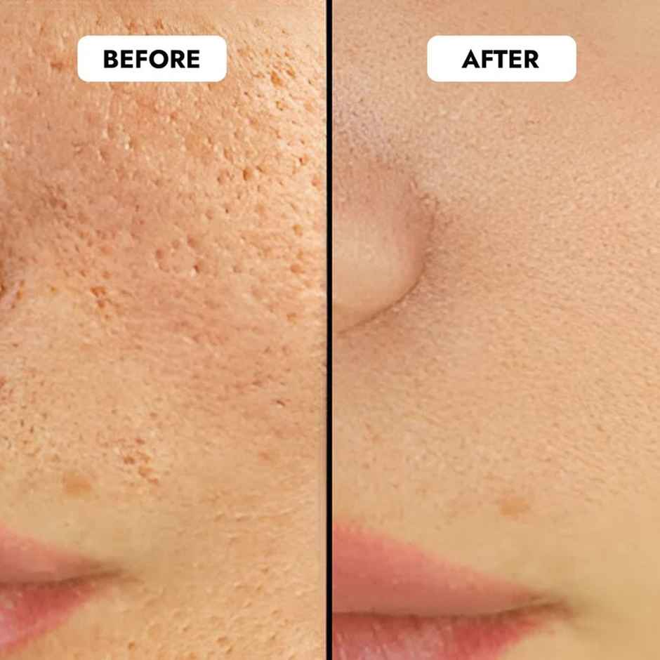 CosIQ 5% Niacinamide Face Serum Refines Pores, Fades Acne Marks & Deeply Hydrates for All Skin Types