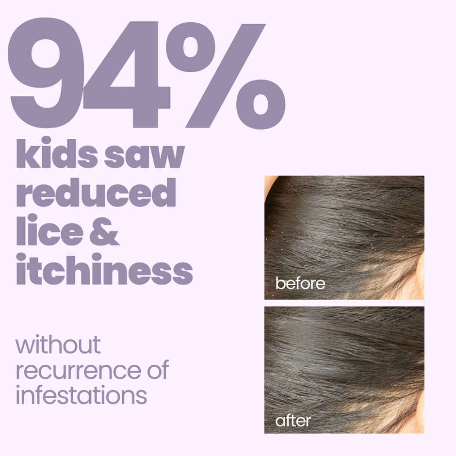 Tuco Kids Natural Anti Lice Shampoo