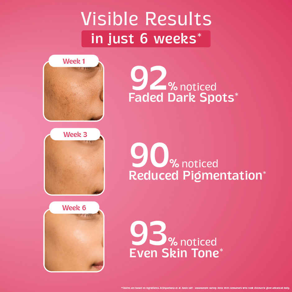 Chicnutrix Glow Advanced for Acne and Pigmentation Control