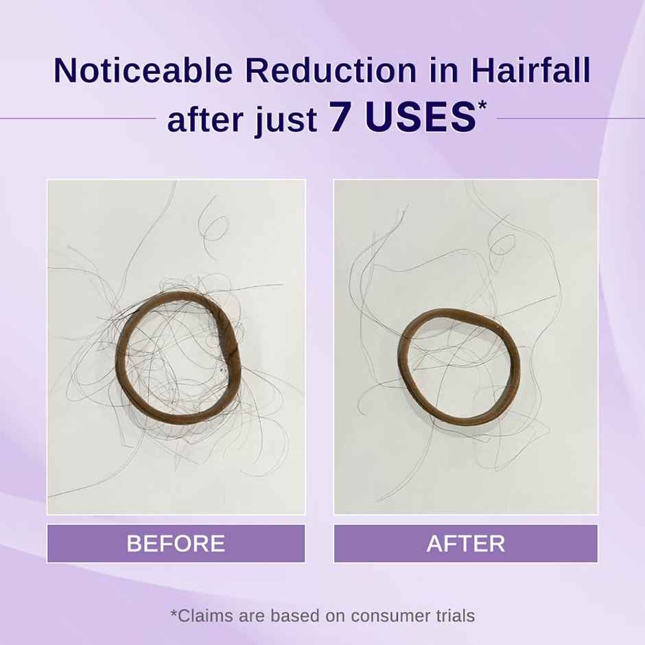 Bare Anatomy Rosemary Hibiscus Hair Growth Oil Nourishes, Strengthens & Controls Hair Fall