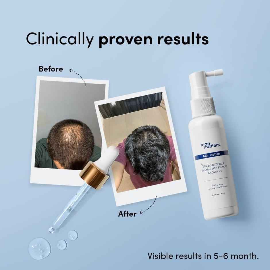 Man Matters Minoxidil 5% Growmax Topical Solution | For stage 2 hairfall