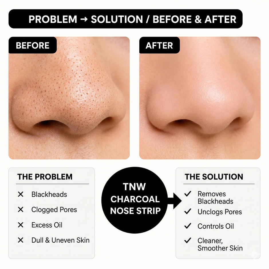 The Natural Wash Charcoal Nose Strips For Blackheads And Whiteheads | With Witch Hazel