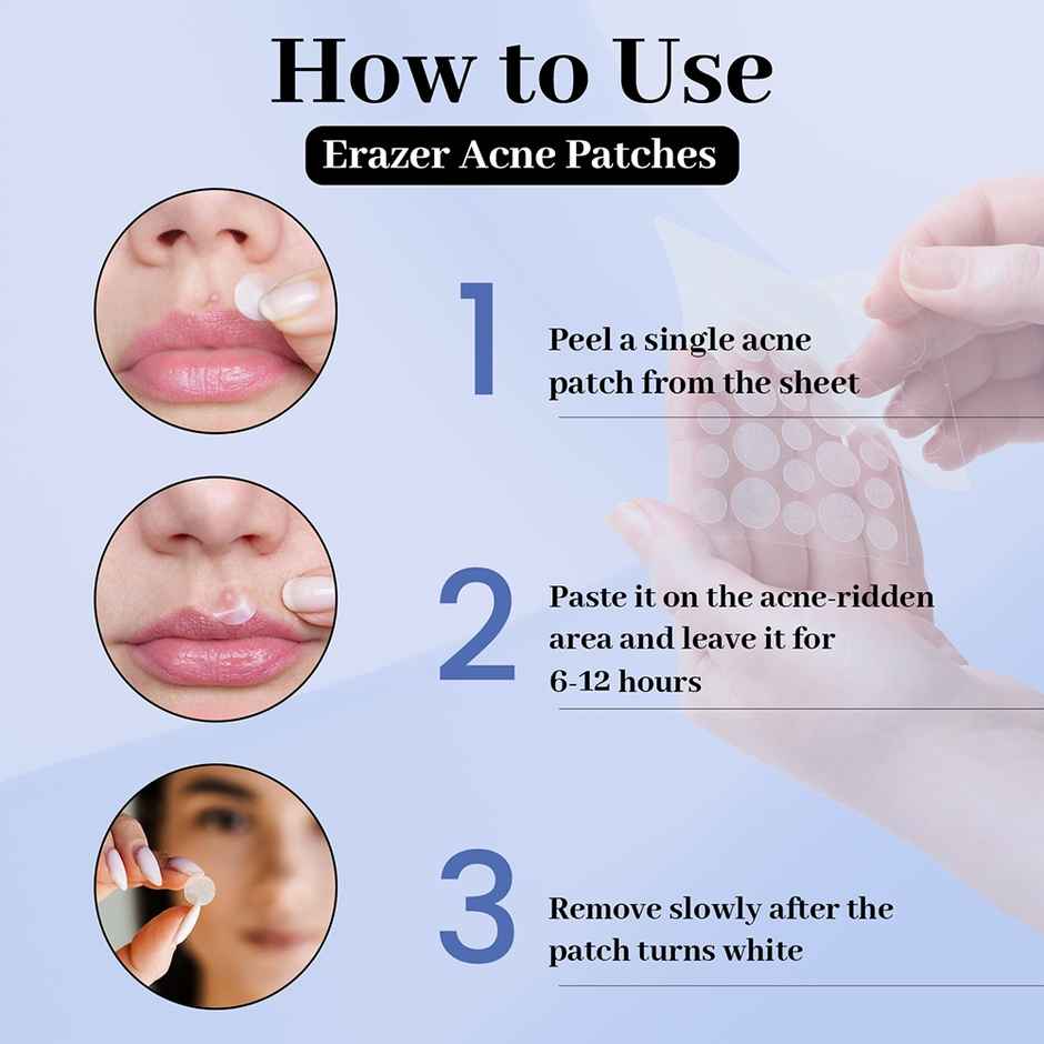 Enn Beauty Erazer Acne Patches & 2 Deep Cleansing Nose Strip Combo