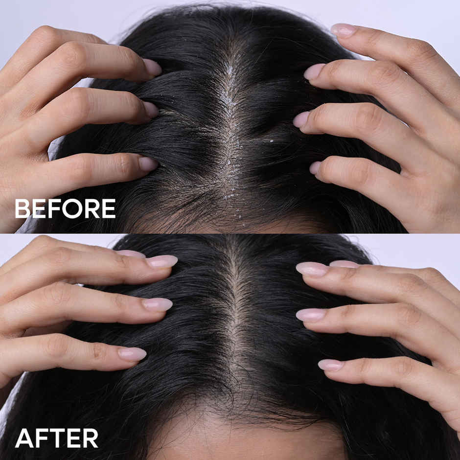 Naturali Anti-Dandruff Hair Mask - Hemp | Sage | Salicylic Acid | Clarifies Scalp