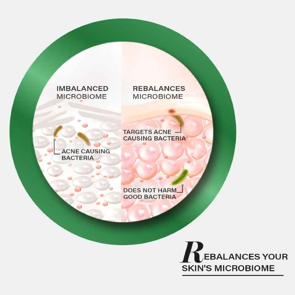 Novology Acne Serum | Face Serum For Acne | Whiteheads | Non-Sticky | Non-Comedogenic Formula