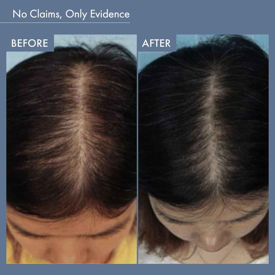 Thriveco Hair Vitalizing Rosemary Shampoo For Hair Fall Control