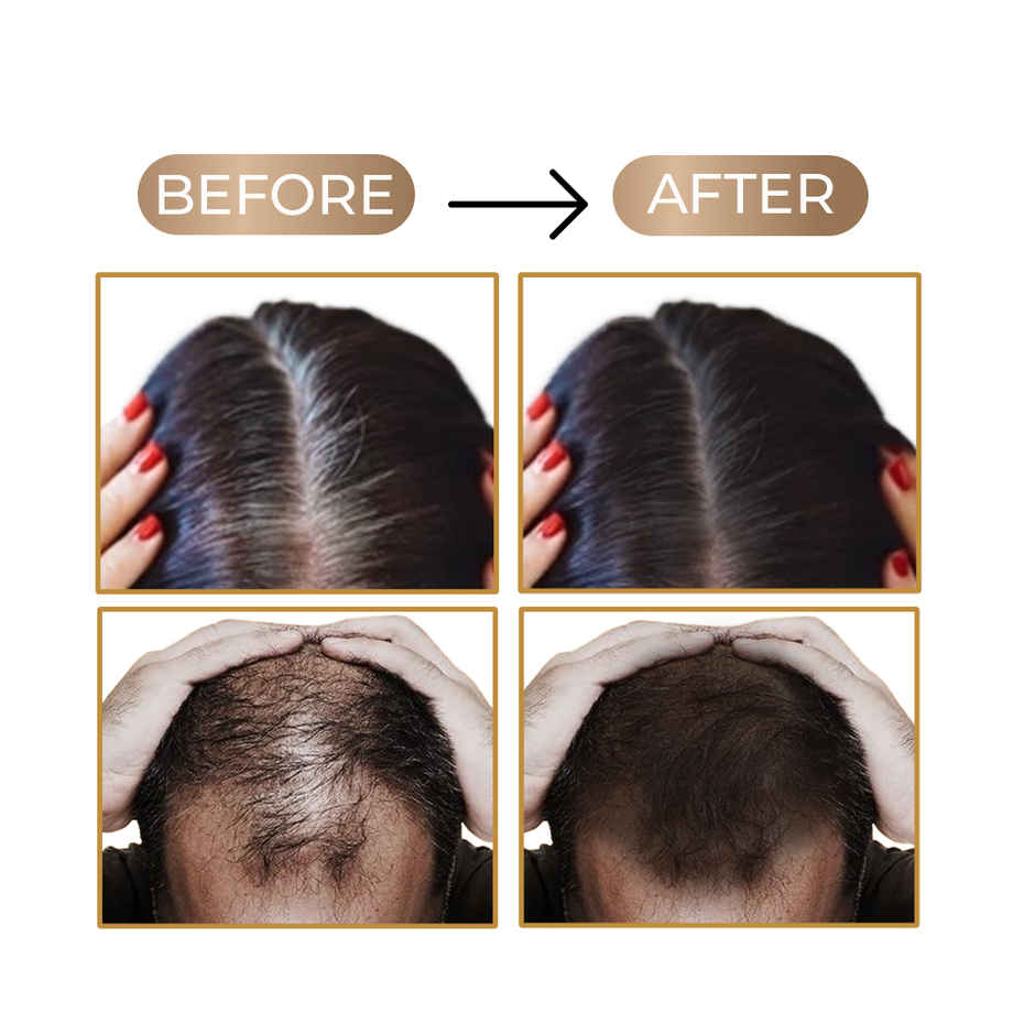 Streax Root Touch Up Powder, Black, Covers Grey Hair & Bald Patches Instantly