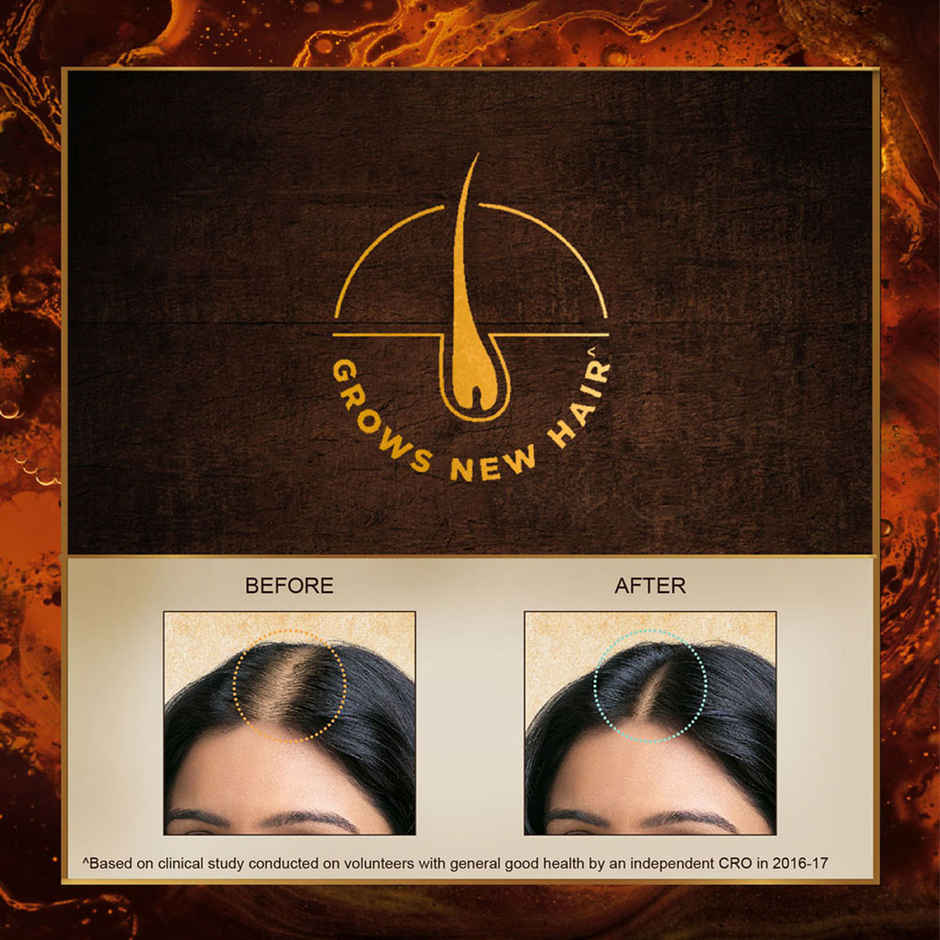 Indulekha Bringha Oil | Reduces Hair Fall And Grows New Hair | 100% Ayurvedic Oil