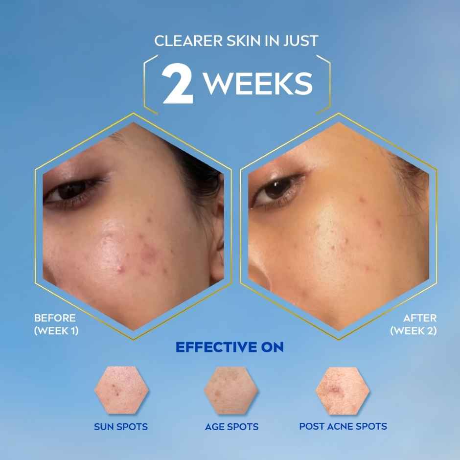 Nivea Luminous Even Glow Oil Control Serum| Thiamidol, Salicylic, Hyaluronic Acid| Reduces Dark Spot (40ml) & Nivea Luminous Even Glow Face Wash | Oil Free Formula, Aha, Aloe Vera, Guarana Extract | Deep Clean (100ml) & Nivea Luminous Even Glow Oil Control Day Cream Spf 50,Thiamidol |Uv Protection & Reduces Dark Spots (40ml) & Nivea Luminous Even Glow Night Cream |Thiamidol & Hyaluronic Acid |Moisturizes & Reduces Dark Spots (40ml) Combo