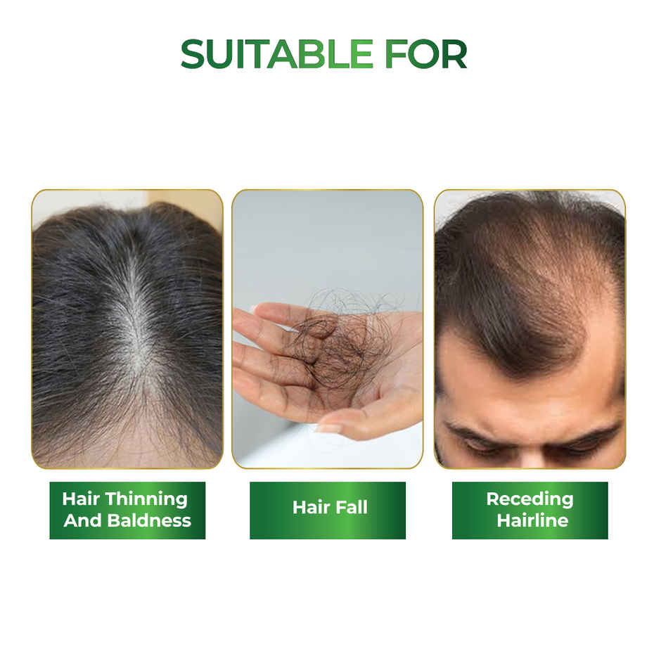 Streax Rosemary Water Spray for Hair Growth