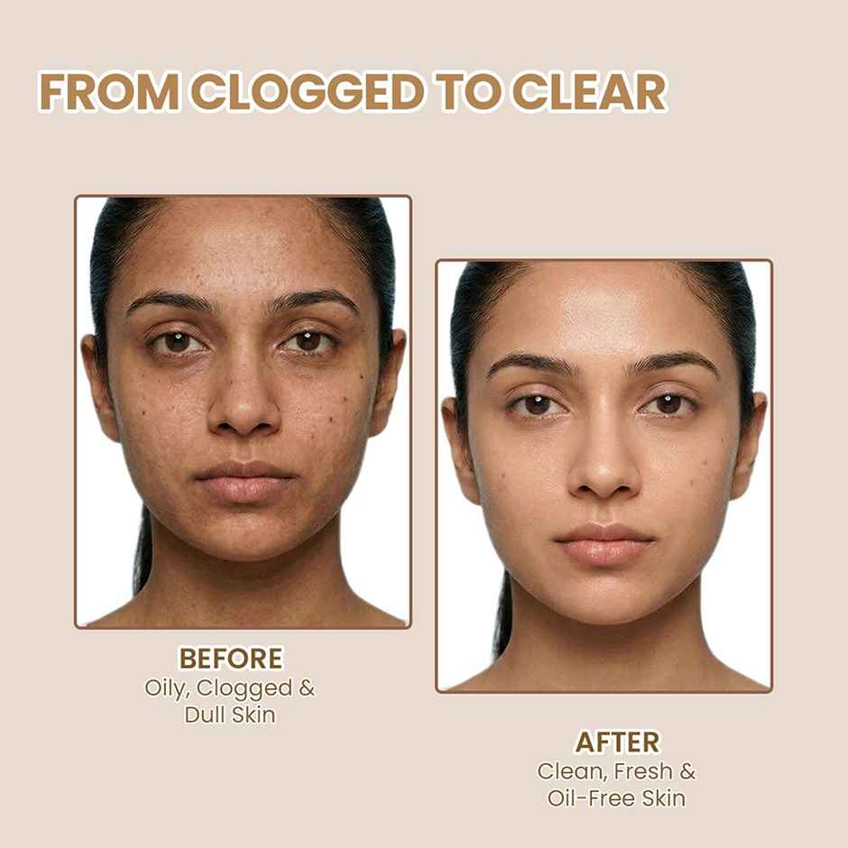 TNW The Natural Wash Multani Mitti Face Wash for Removing Pigmentation, Controls Acne & Excess Oil Combo