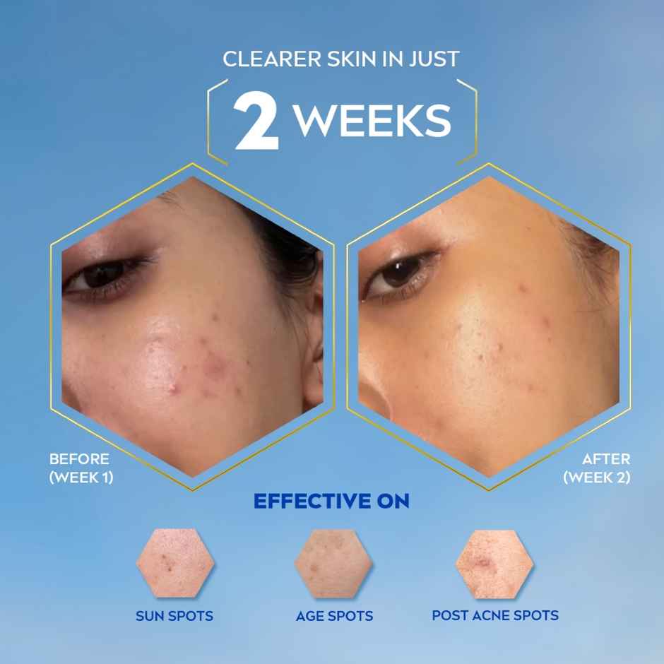 NIVEA Luminous Even Glow Night Cream |Thiamidol & Hyaluronic Acid |Moisturizes & Reduces Dark Spots