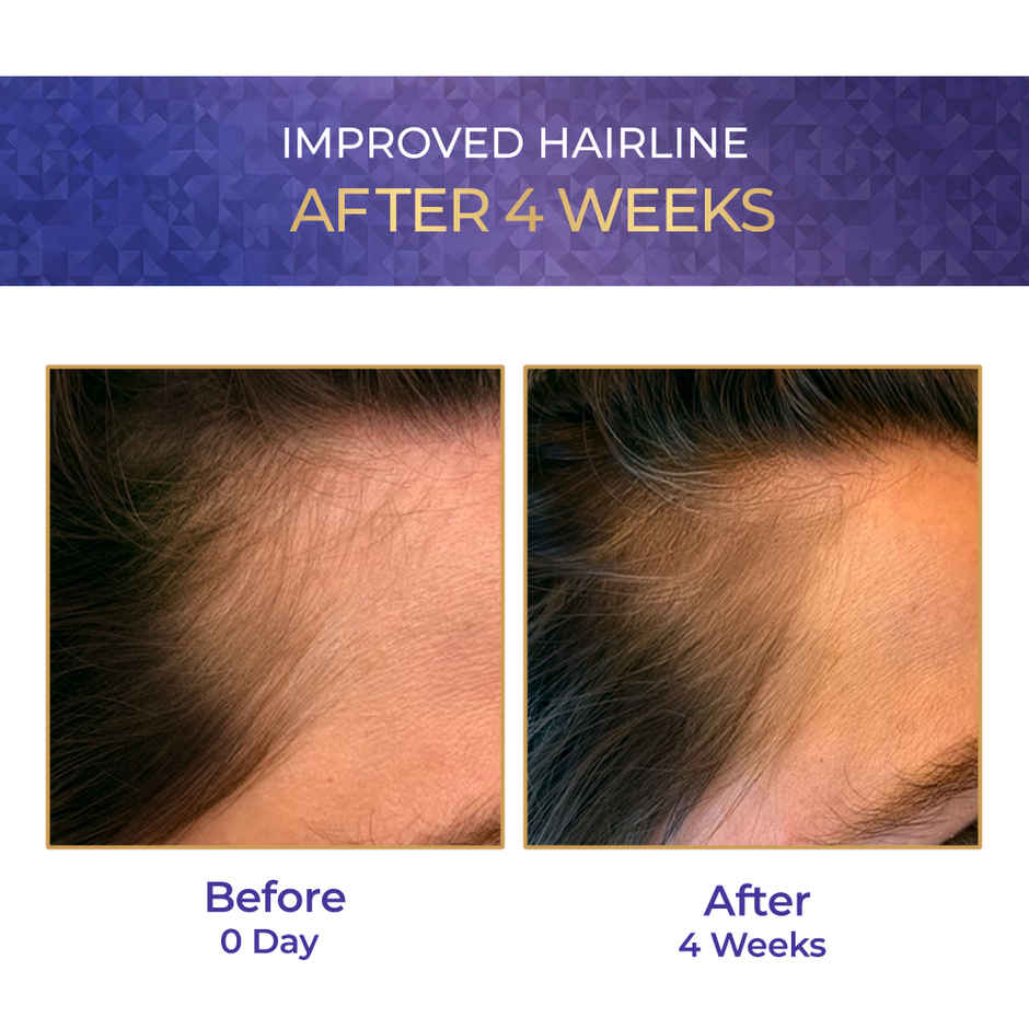 Streax Vitagrowth Hair Serum with 3% Redensyl, 4% Anagain, 3% Baicapil, Biotin & Caffeine