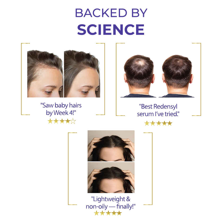 Streax Vitagrowth Hair Serum with 3% Redensyl, 4% Anagain, 3% Baicapil, Biotin & Caffeine