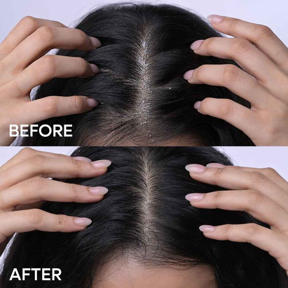 Naturali Anti-Dandruff Hair Mask - Hemp | Sage | Salicylic Acid | Clarifies Scalp