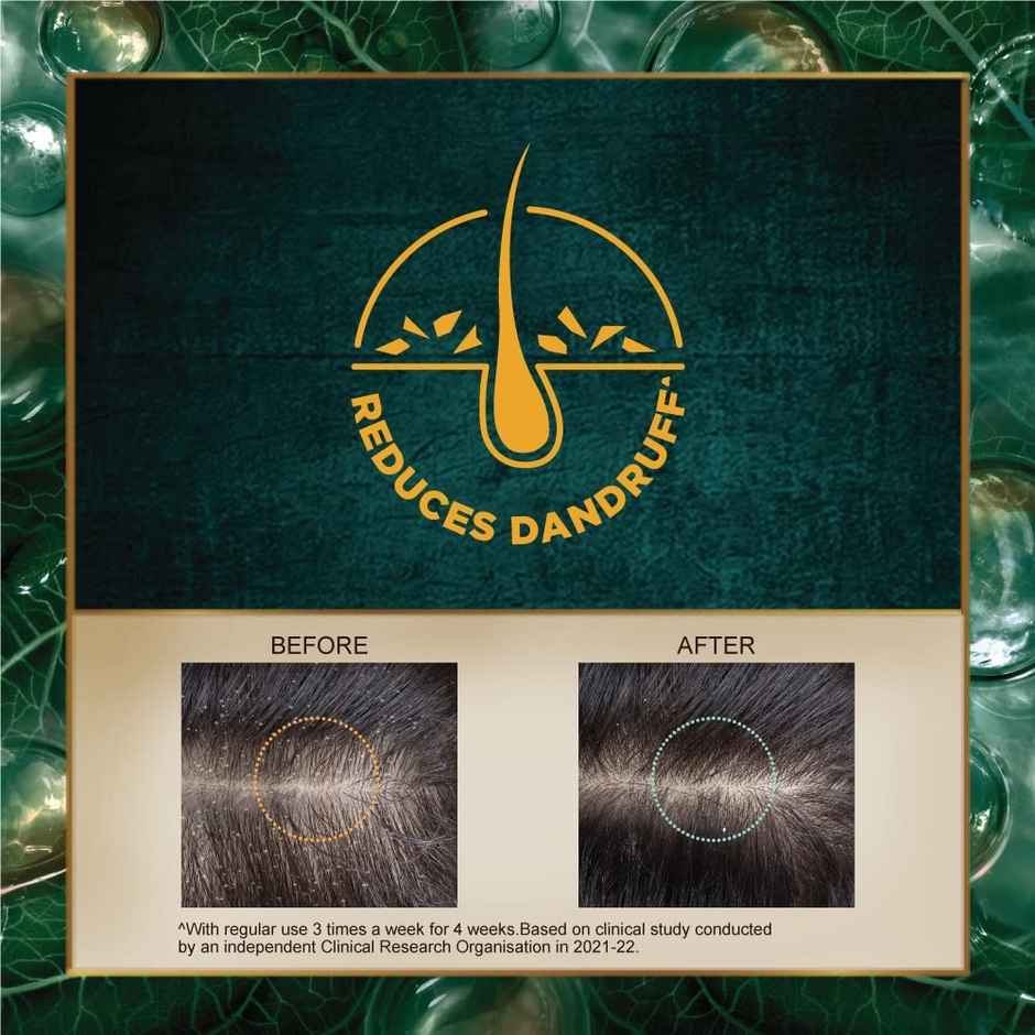 Indulekha Dandruff Treatment Shampoo