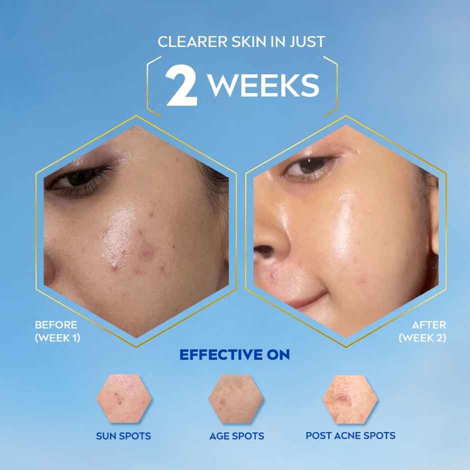 NIVEA Luminous Even Glow Oil Control Serum| Thiamidol, Salicylic, Hyaluronic Acid| Reduces Dark Spot