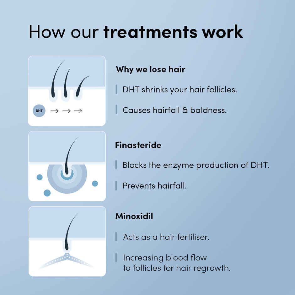Man Matters Minoxifin Topical Solution | 5% minoxidil and 0.1% Finasteride | For stage 3 hairfall