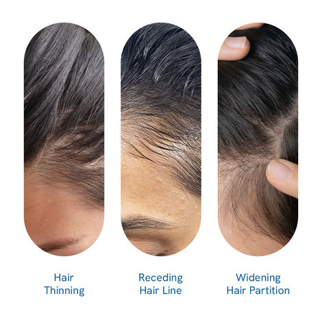 Be Bodywise 3% Rosemary Hair Growth Serum Roll-On