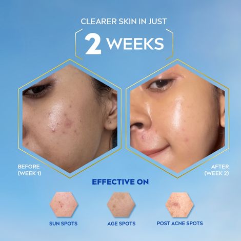 NIVEA Luminous Even Glow Oil Control Day Cream SPF 50,Thiamidol |UV protection & Reduces Dark Spots