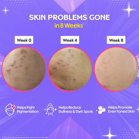 Chicnutrix Glow Japanese Glutathione & Vit. C for Brighter Skin| Strawberry-Lemon flavour