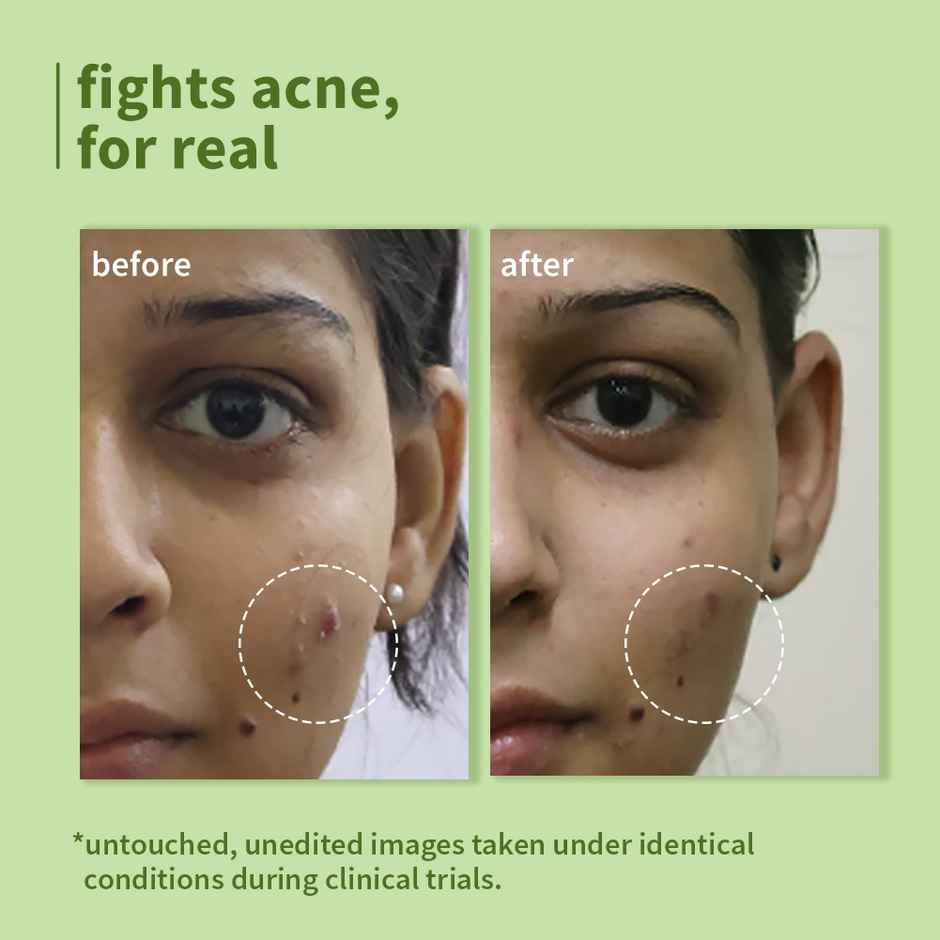 Plum Green Tea Pore Cleansing Face Wash Fights Pimples & Removes Excess Oil Enriched With Green Tea & Glycolic Acid Best Suits Oily Acne-Prone Combination Skin 100% Vegan