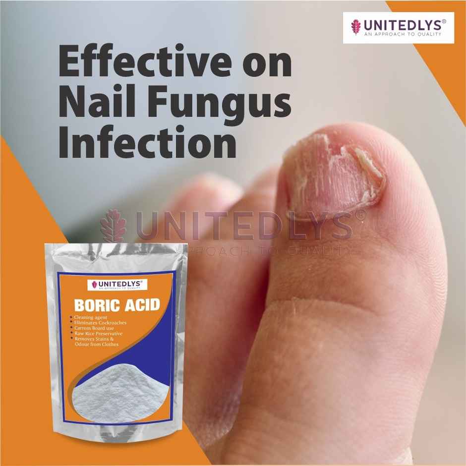 Unitedlys Multi-Purpose Boric Acid Powder with Measuring Spoon | 100% Pure Boric For Cockroaches