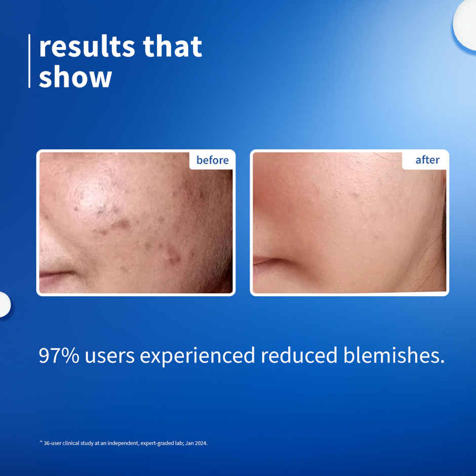 Plum 10% Niacinamide Face Serum with Rice Water & Squalane