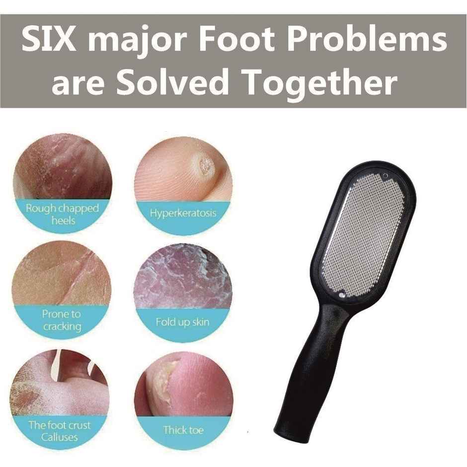 Beautiliss Metal Foot Filer Scrubber For Dead Skin Callus Remover Pedicure Tool