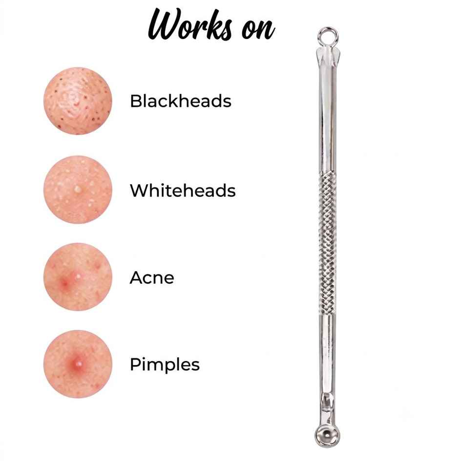 Beautiliss Blackhead Remover Round Tool for Clear Smooth Skin and Effective Pore Cleaning